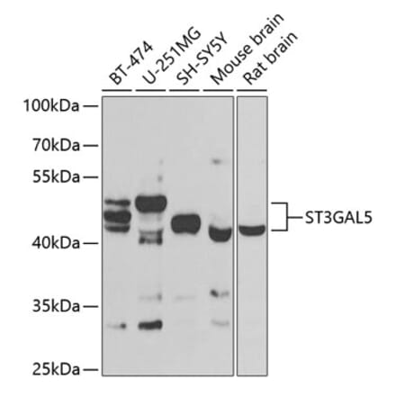 Western Blot - Anti-ST3GAL5 Antibody (A15996) - Antibodies.com