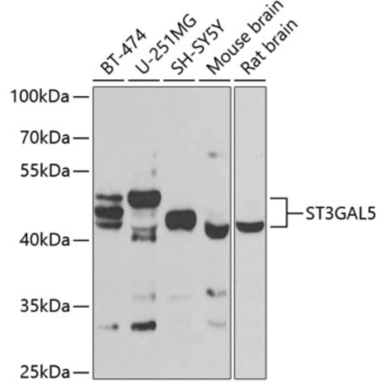 Western Blot - Anti-ST3GAL5 Antibody (A15996) - Antibodies.com