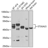 Western Blot - Anti-ST3GAL5 Antibody (A15996) - Antibodies.com