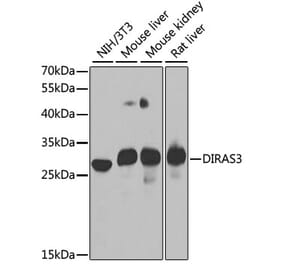 Western Blot - Anti-ARHI Antibody (A15998) - Antibodies.com