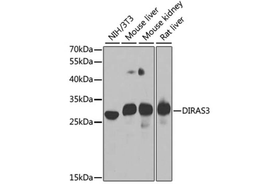 Western Blot - Anti-ARHI Antibody (A15998) - Antibodies.com
