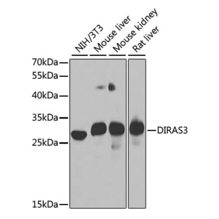 Western Blot - Anti-ARHI Antibody (A15998) - Antibodies.com