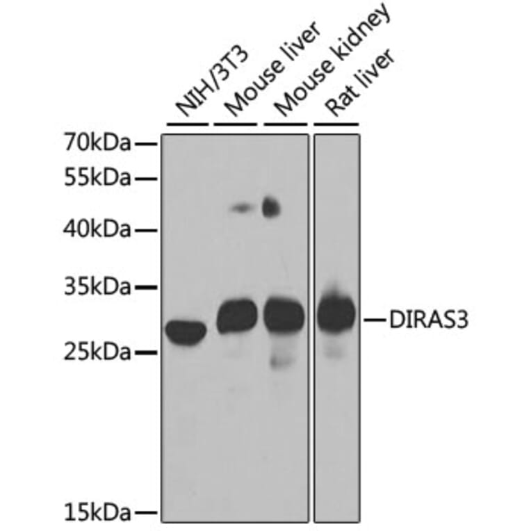 Western Blot - Anti-ARHI Antibody (A15998) - Antibodies.com