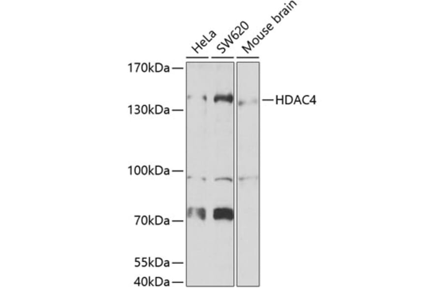 Western Blot - Anti-HDAC4 Antibody (A15999) - Antibodies.com