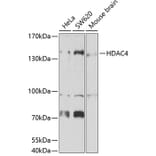 Western Blot - Anti-HDAC4 Antibody (A15999) - Antibodies.com