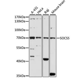 Western Blot - Anti-SOCS5 Antibody (A16000) - Antibodies.com