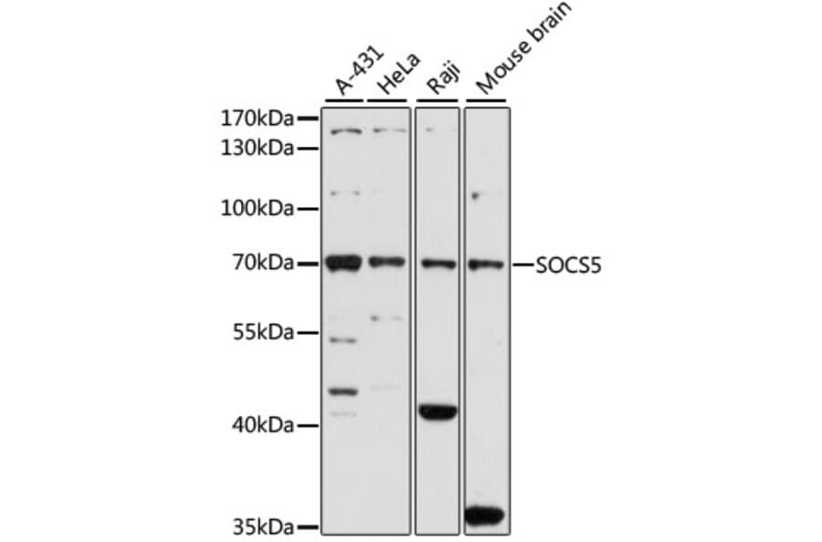 Western Blot - Anti-SOCS5 Antibody (A16000) - Antibodies.com