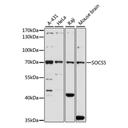 Western Blot - Anti-SOCS5 Antibody (A16000) - Antibodies.com
