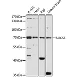 Western Blot - Anti-SOCS5 Antibody (A16000) - Antibodies.com