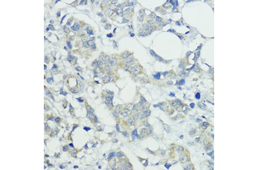 Immunohistochemistry - Anti-SOCS5 Antibody (A16000) - Antibodies.com