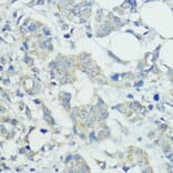 Immunohistochemistry - Anti-SOCS5 Antibody (A16000) - Antibodies.com
