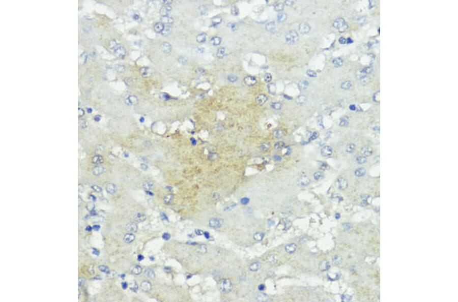 Immunohistochemistry - Anti-SOCS5 Antibody (A16000) - Antibodies.com