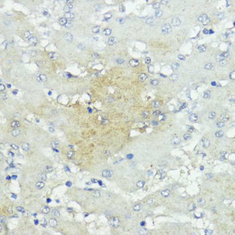 Immunohistochemistry - Anti-SOCS5 Antibody (A16000) - Antibodies.com