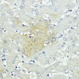 Immunohistochemistry - Anti-SOCS5 Antibody (A16000) - Antibodies.com