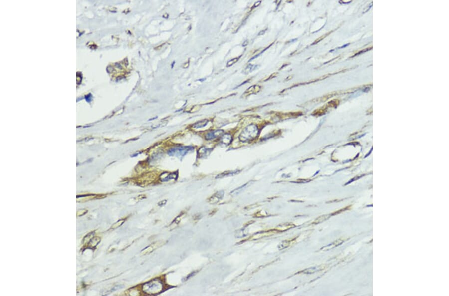 Immunohistochemistry - Anti-SOCS5 Antibody (A16000) - Antibodies.com
