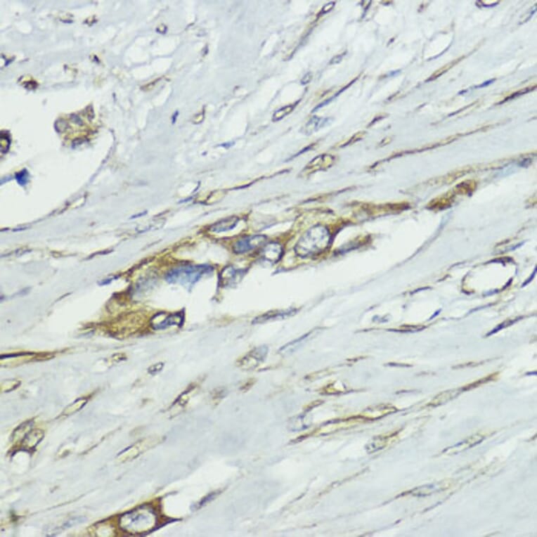 Immunohistochemistry - Anti-SOCS5 Antibody (A16000) - Antibodies.com