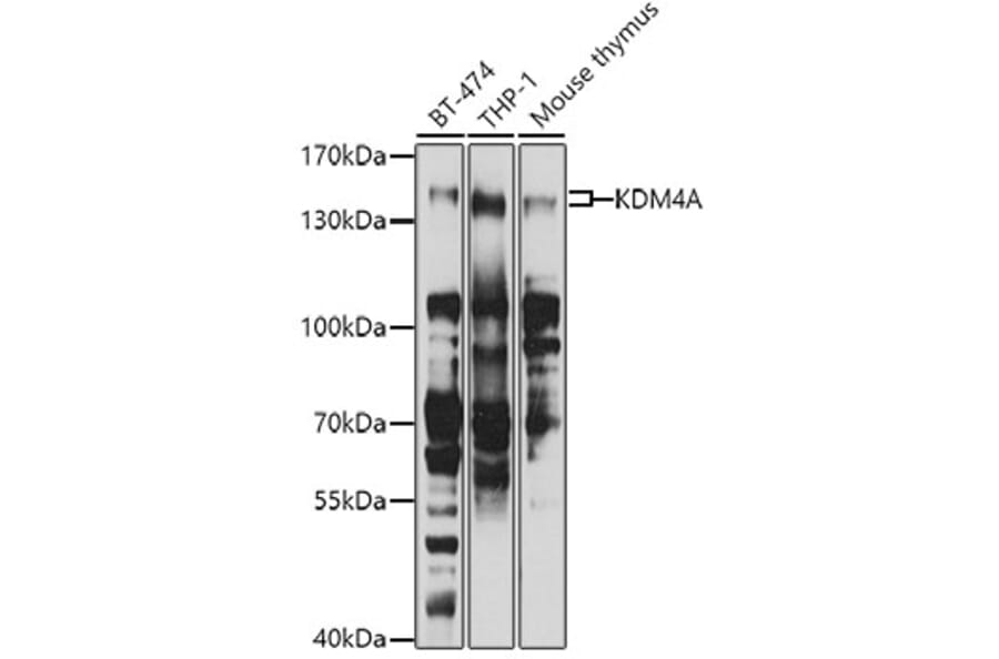 Western Blot - Anti-KDM4A/JHDM3A/JMJD2A Antibody (A16001) - Antibodies.com
