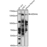 Western Blot - Anti-KDM4A/JHDM3A/JMJD2A Antibody (A16001) - Antibodies.com