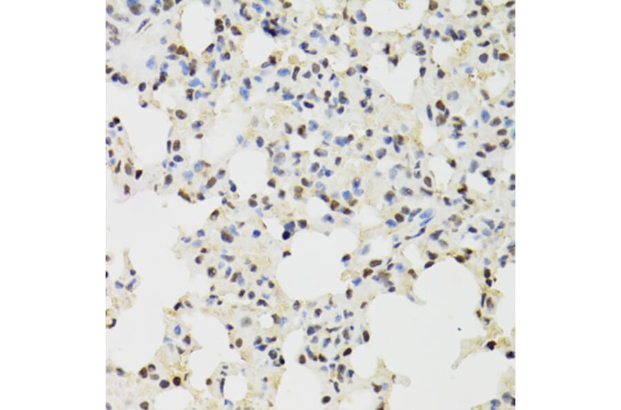 Immunohistochemistry - Anti-KDM4A/JHDM3A/JMJD2A Antibody (A16001) - Antibodies.com