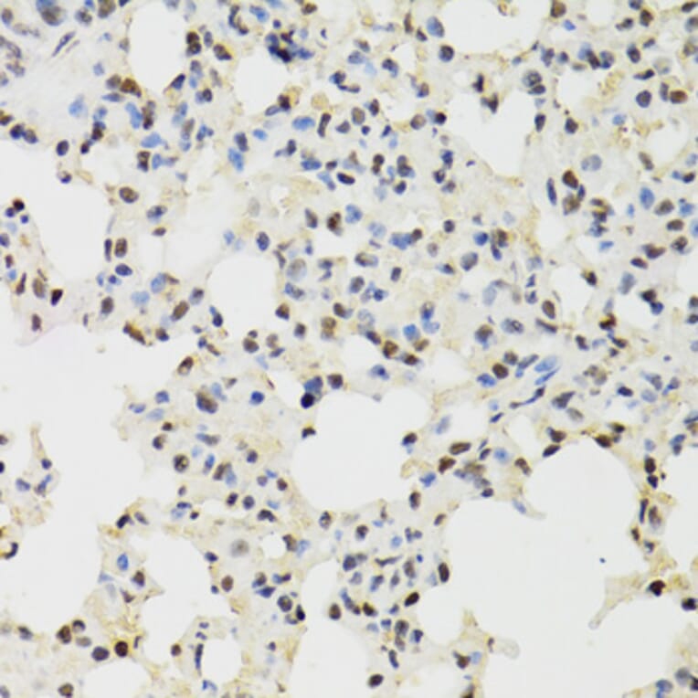 Immunohistochemistry - Anti-KDM4A/JHDM3A/JMJD2A Antibody (A16001) - Antibodies.com