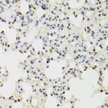 Immunohistochemistry - Anti-KDM4A/JHDM3A/JMJD2A Antibody (A16001) - Antibodies.com
