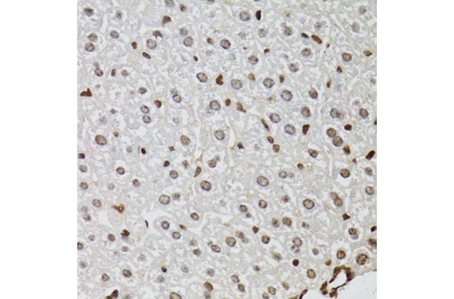 Immunohistochemistry - Anti-KDM4A/JHDM3A/JMJD2A Antibody (A16001) - Antibodies.com