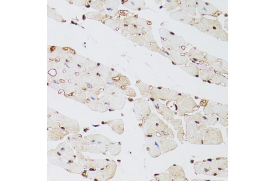 Immunohistochemistry - Anti-KDM4A/JHDM3A/JMJD2A Antibody (A16001) - Antibodies.com