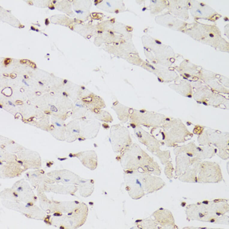 Immunohistochemistry - Anti-KDM4A/JHDM3A/JMJD2A Antibody (A16001) - Antibodies.com