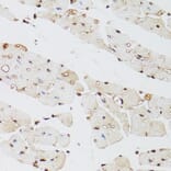 Immunohistochemistry - Anti-KDM4A/JHDM3A/JMJD2A Antibody (A16001) - Antibodies.com