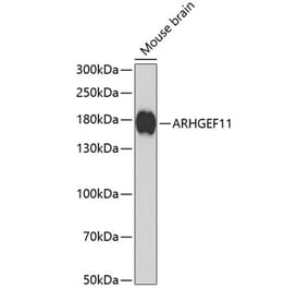 Western Blot - Anti-PDZ-RhoGEF Antibody (A16002) - Antibodies.com