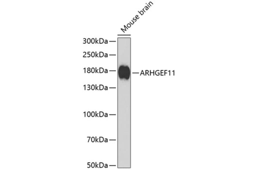 Western Blot - Anti-PDZ-RhoGEF Antibody (A16002) - Antibodies.com