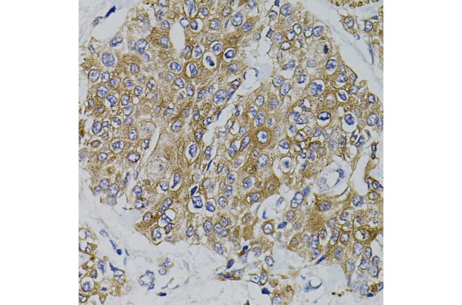Immunohistochemistry - Anti-PDZ-RhoGEF Antibody (A16002) - Antibodies.com