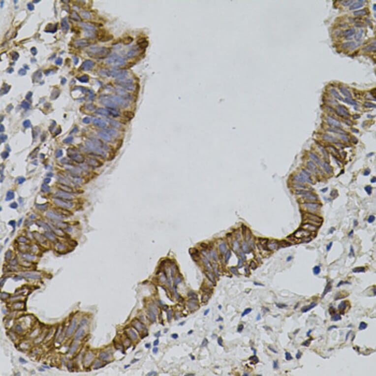 Immunohistochemistry - Anti-PDZ-RhoGEF Antibody (A16002) - Antibodies.com