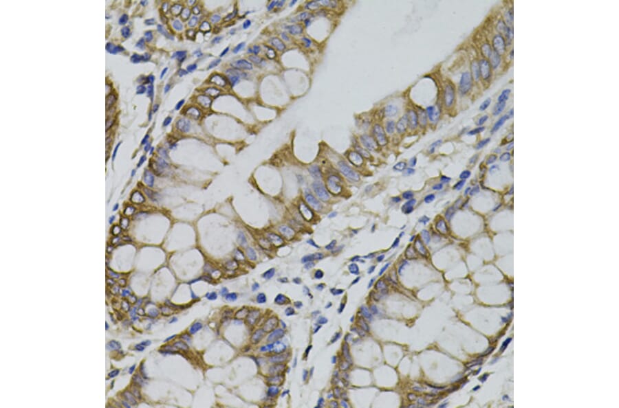 Immunohistochemistry - Anti-PDZ-RhoGEF Antibody (A16002) - Antibodies.com