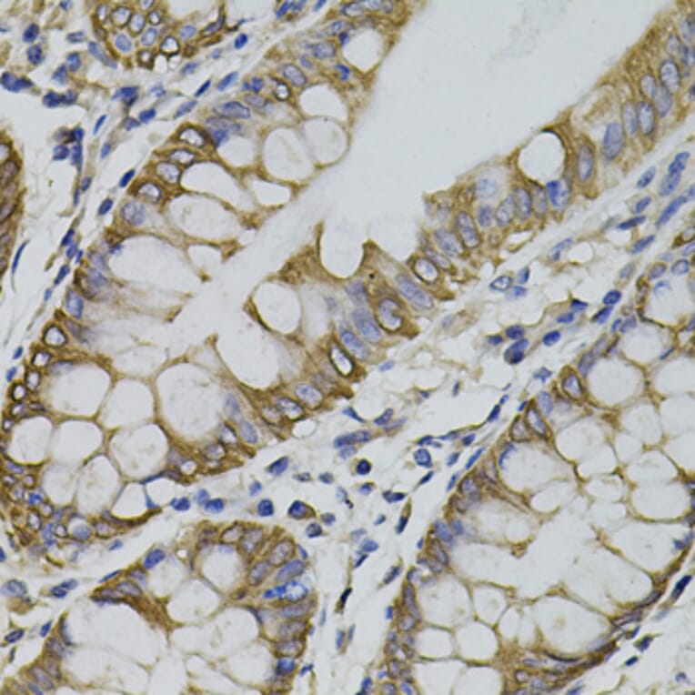 Immunohistochemistry - Anti-PDZ-RhoGEF Antibody (A16002) - Antibodies.com