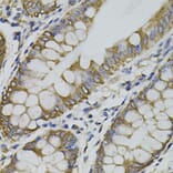 Immunohistochemistry - Anti-PDZ-RhoGEF Antibody (A16002) - Antibodies.com