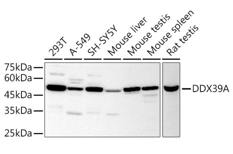 Western Blot - Anti-DDX39 Antibody (A16003) - Antibodies.com