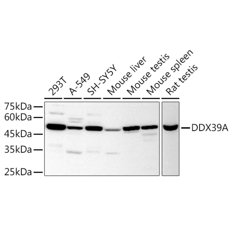 Western Blot - Anti-DDX39 Antibody (A16003) - Antibodies.com