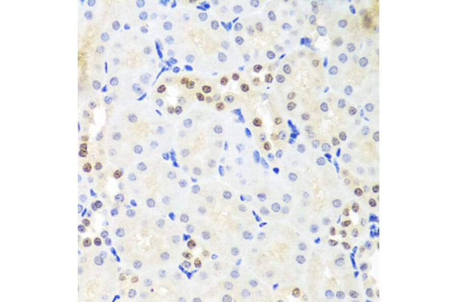 Immunohistochemistry - Anti-DDX39 Antibody (A16003) - Antibodies.com