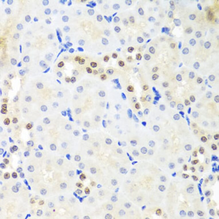 Immunohistochemistry - Anti-DDX39 Antibody (A16003) - Antibodies.com