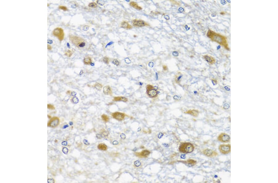 Immunohistochemistry - Anti-DDX39 Antibody (A16003) - Antibodies.com