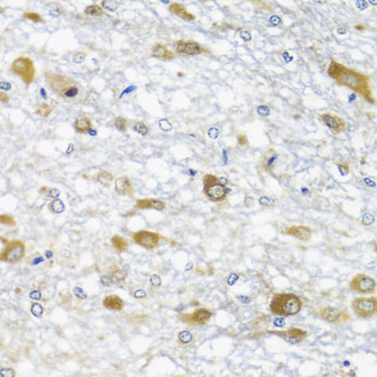 Immunohistochemistry - Anti-DDX39 Antibody (A16003) - Antibodies.com