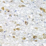 Immunohistochemistry - Anti-DDX39 Antibody (A16003) - Antibodies.com