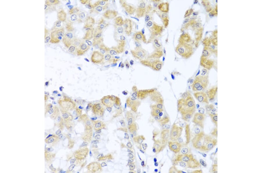Immunohistochemistry - Anti-DDX39 Antibody (A16003) - Antibodies.com
