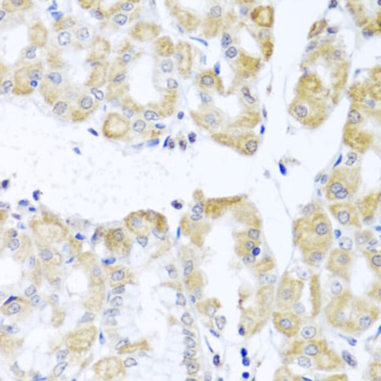 Immunohistochemistry - Anti-DDX39 Antibody (A16003) - Antibodies.com