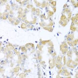 Immunohistochemistry - Anti-DDX39 Antibody (A16003) - Antibodies.com