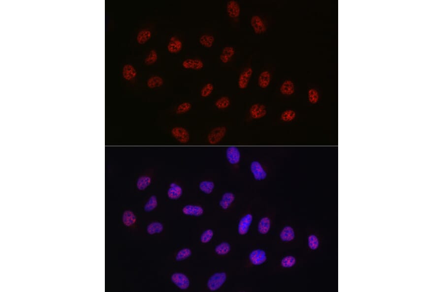 Immunofluorescence - Anti-DDX39 Antibody (A16003) - Antibodies.com