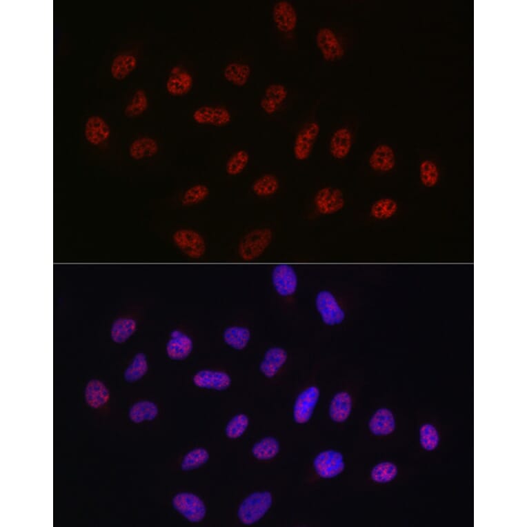 Immunofluorescence - Anti-DDX39 Antibody (A16003) - Antibodies.com