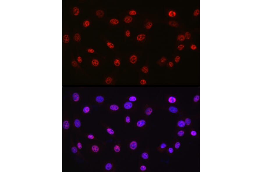 Immunofluorescence - Anti-DDX39 Antibody (A16003) - Antibodies.com