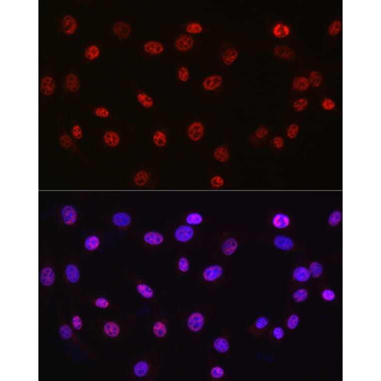 Immunofluorescence - Anti-DDX39 Antibody (A16003) - Antibodies.com
